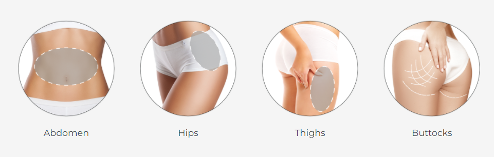 أفضل سعر لآلة نحت الجسم بالتبريد الدهون تجميد