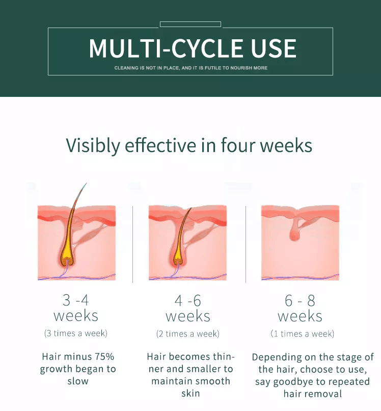 آلة صغيرة للاستخدام المنزلي لإزالة الشعر بالليزر الدائم IPL آلة إزالة الشعر بالليزر الدائم للاستخدام المنزلي
