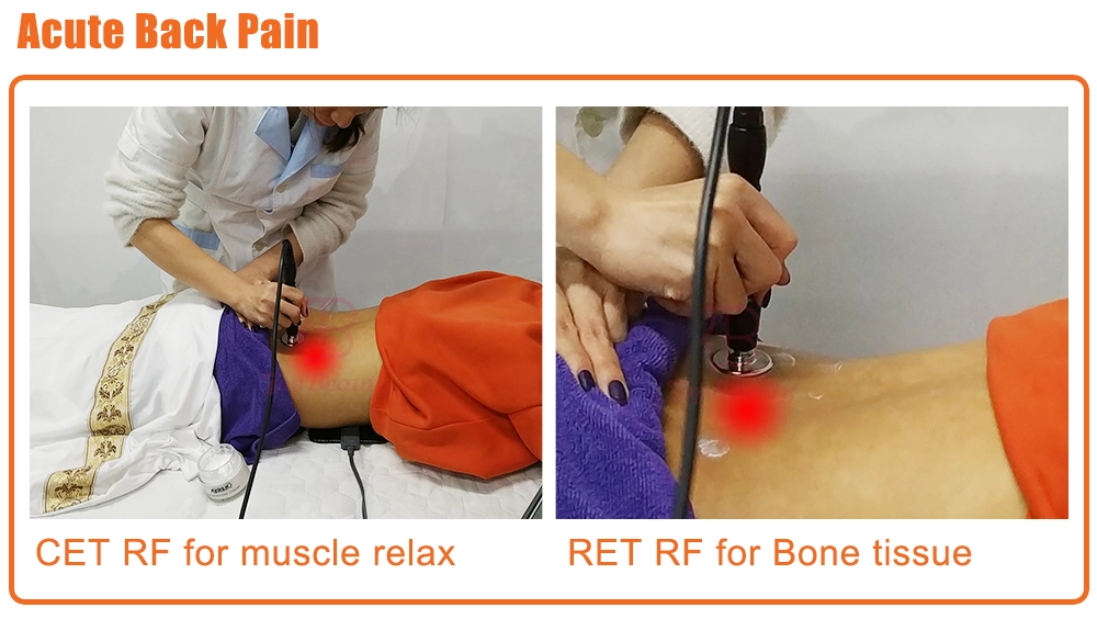 علاج تيكار للعلاج الطبيعي جهاز تيكار أحادي القطب مقاوم وتكثيفي تيكارتيرابيا احترافي