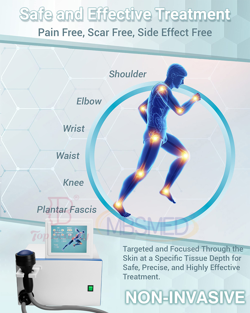 بيع ساخن نظام صدمة موجة eswt ed التركيز، آلة العلاج بالصدمات الموجية المركزة، الصدمة الموجية الفيزيائية