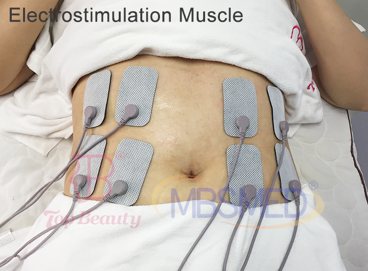 جهاز علاج تيكار إنديبا 448 كيلوهرتز لتخفيف الألم، جهاز تحفيز العضلات بالراديو تردد إنديبا لتنسيق الجسم وآلة العلاج الطبيعي