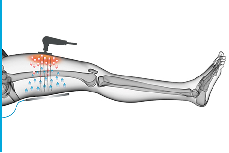 صورة توضح تقنية المقاومة