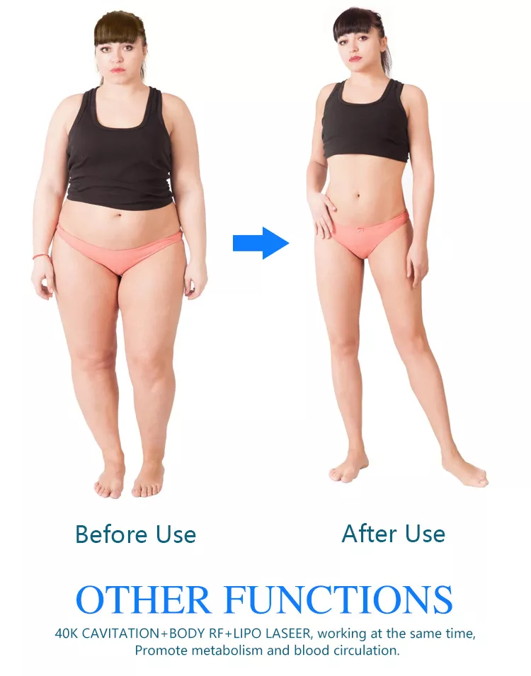 وصول جديد 2022 cryolipolysis محمول 360 جسم تجميد آلة نحت الجسم البارد / آلة cryolipolisis 360