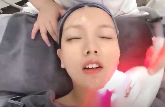 صورة لجهاز تجديد شباب البشرة بالقرب من الضوء الأحمر