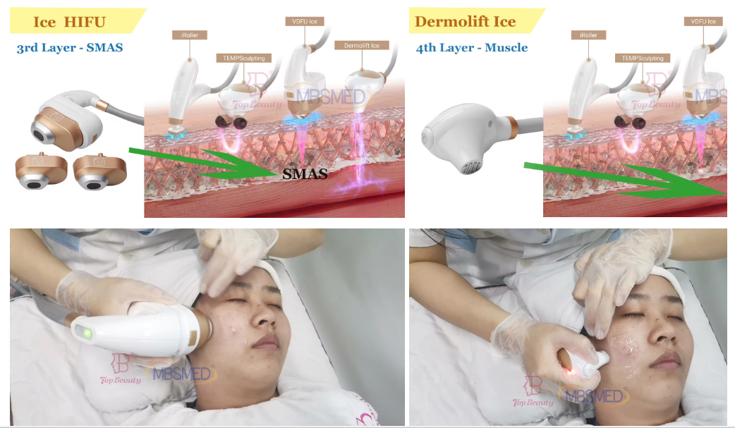 آلة 12D ICE hifu لرفع الوجه وتشد البشرة بجهاز HIFU