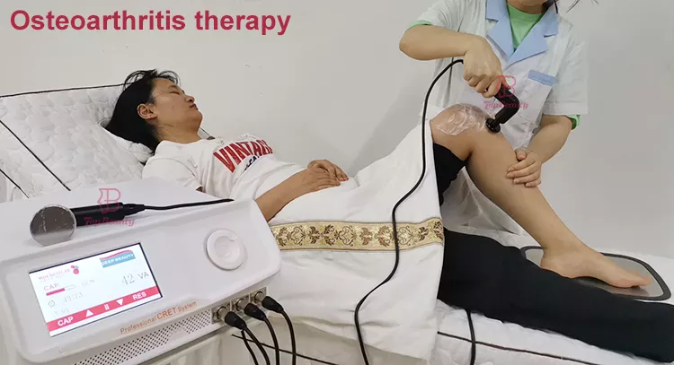 صورة توضح تأثير العلاج بالترددات الراديوية