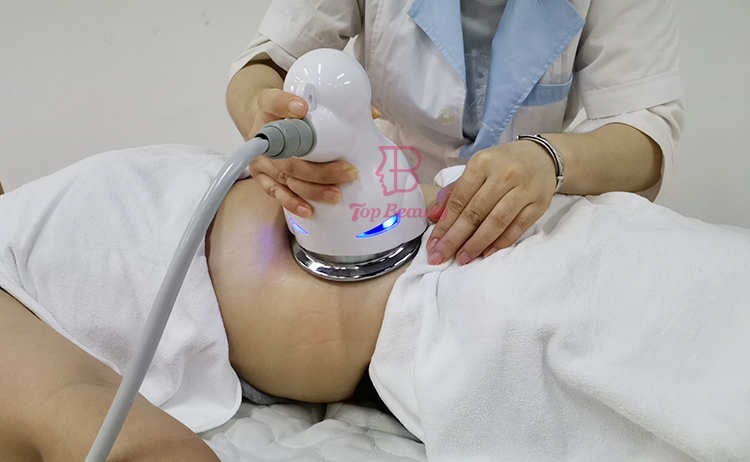 آلة نحت الجسم بكرة 5D للتخلص من السيلوليت، جهاز علاج التفريغ بالتفريغ Endosferas Slimming