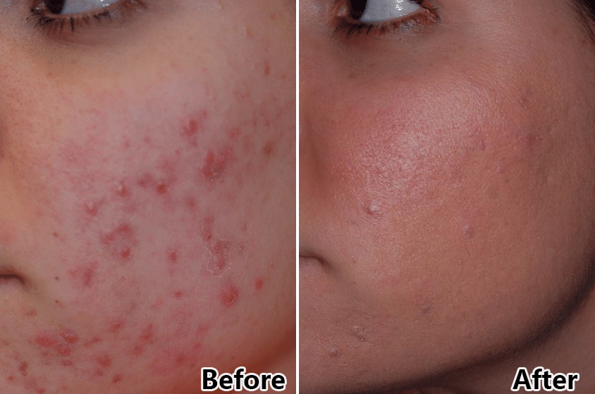 جهاز علاج الوجه بضوء LED ب7 ألوان للعناية بالبشرة والعلاج بالضوء الفوتونى المزدوج PDT