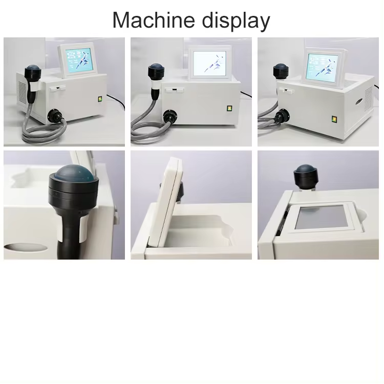 صورة حقيقية لآلة الصدمات المركزة