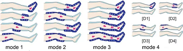 صورة للعلاج بالضغط الهوائي