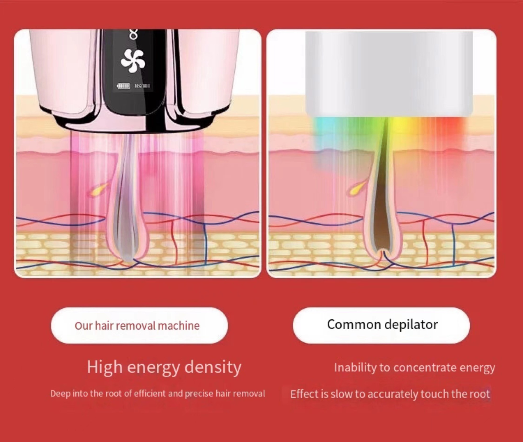منتجات منزلية شائعة آلة إزالة الشعر بالليزر المحمولة باليد لإزالة الشعر بالليزر في المنزل