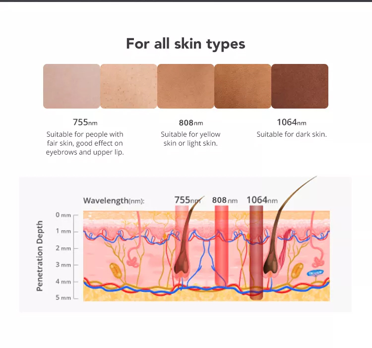 آلة إزالة الشعر بالليزر ثنائي 808 نانومتر الاحترافية