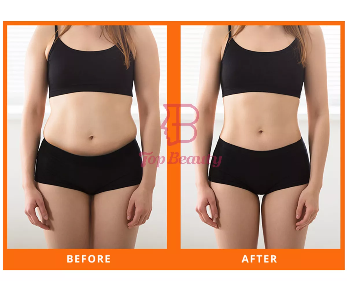 صورة أخرى توضح منطقة العلاج