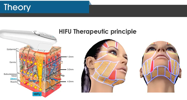 جهاز إعادة تأهيل الجلد بالموجات فوق الصوتية مع دوران 360 درجة لإزالة التجاعيد، جهاز MMFU الرأسي 4D