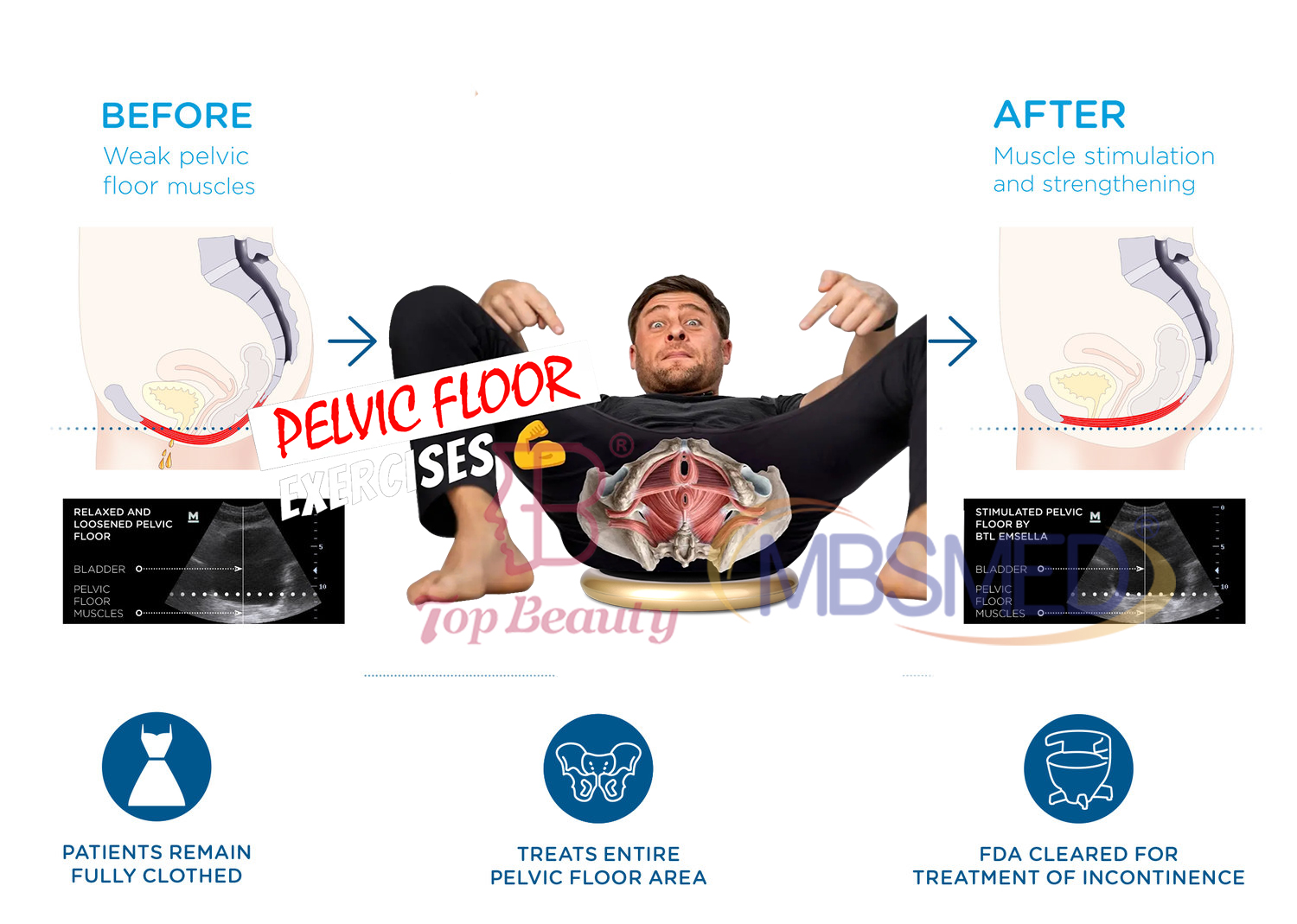 وسادة كرسي عضلات قاع الحوض علاج كرسي قاع الحوض إصلاح EMS كرسي قاع الحوض