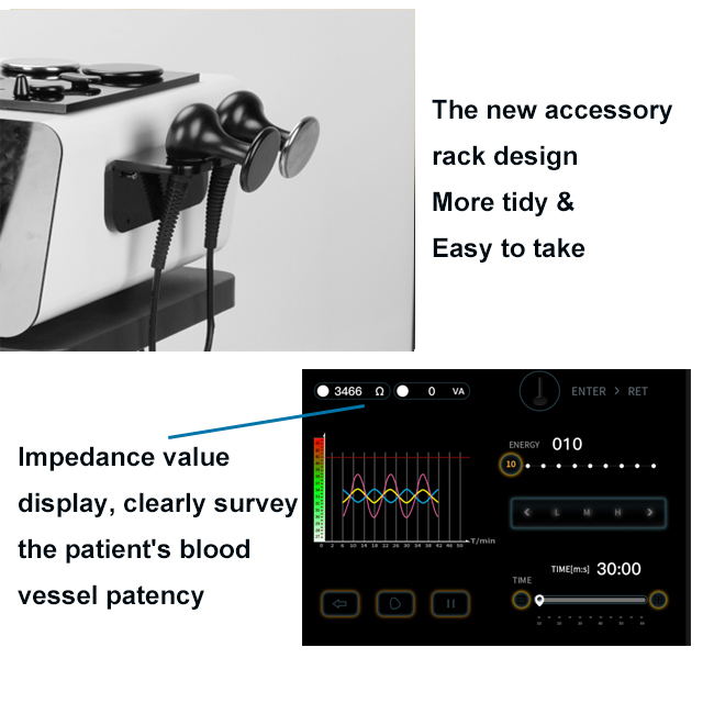 صورة توضح تطبيق تقنية TECAR في العلاج الطبيعي