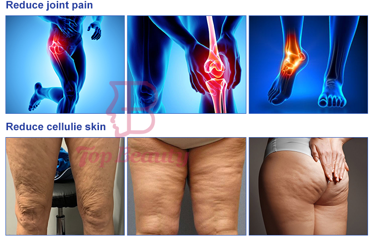 Far infrared air pressure full body slimming suit/vacuum therapy machine