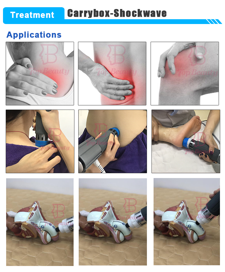 آلة العلاج بالصدمات الكهرومغناطيسية Fswt لضعف الانتصاب وتخفيف الآلام
