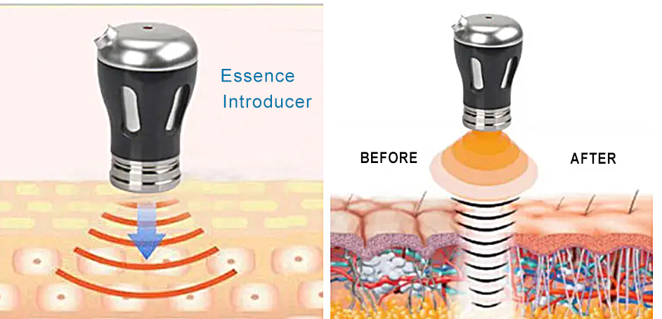 جهاز تجميل RF 2 في 1 جهاز EMS للعناية بالبشرة ومكافحة الشيخوخة جهاز رفع الوجه وإزالة التجاعيد جهاز علاج بالموجات فوق الصوتية EMS