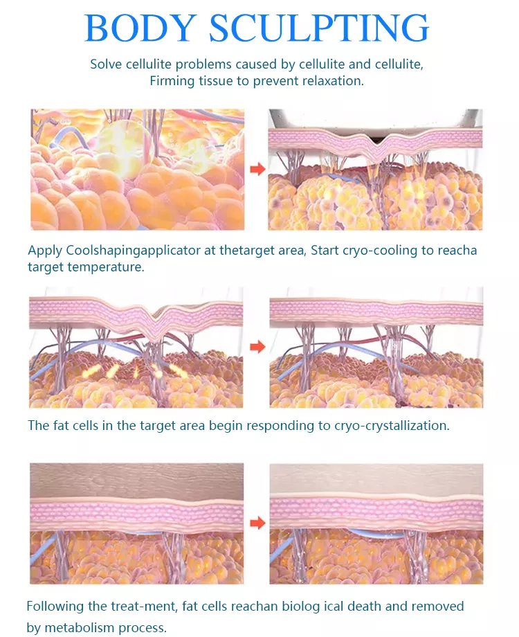 وصول جديد 2022 cryolipolysis محمول 360 جسم تجميد آلة نحت الجسم البارد / آلة cryolipolisis 360