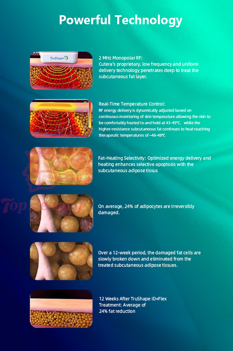 جهاز تروتشيب آي دي إي إم إس لتحفيز العضلات الكهربائي لتشكيل الجسم