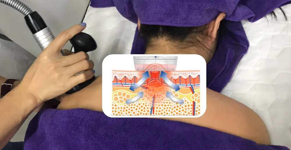 تشكيل الجسم بجهاز EMS 4 في 1 مع أسطوانة تفريغ و RF