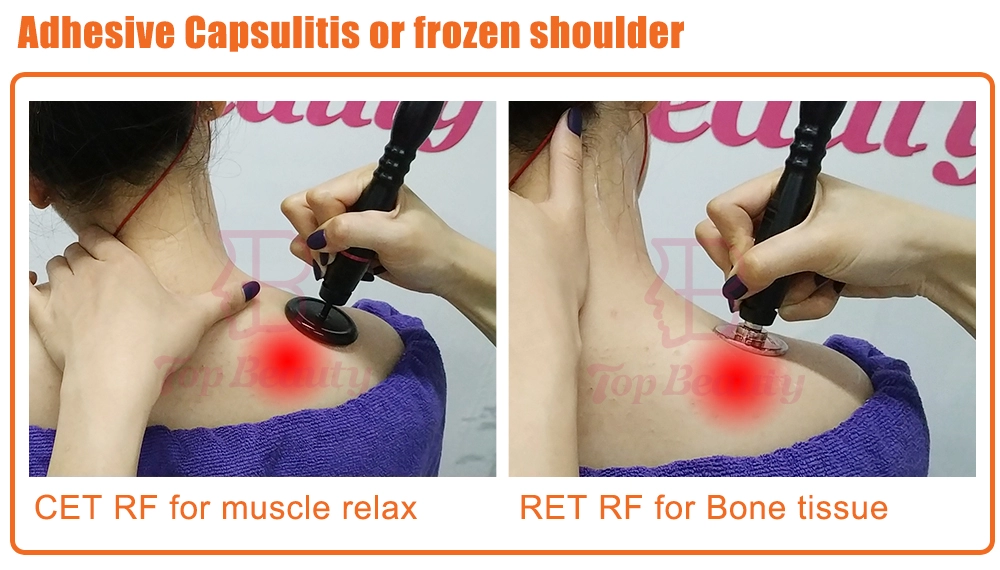 علاج تيكار للعلاج الطبيعي جهاز تيكار أحادي القطب مقاوم وتكثيفي تيكارتيرابيا احترافي