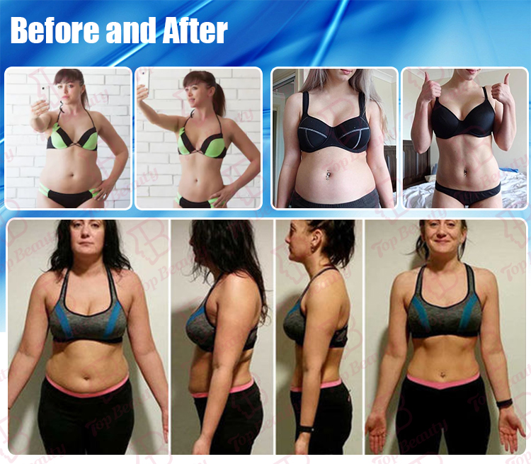 آلة تجويف الدهون 80k آلة تجويف الدهون تفريغ آلة تجويف الدهون نظام شفط الدهون كيم 8 نظام تنحيف -