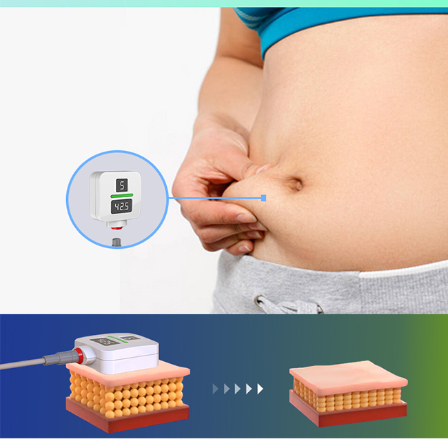 آلة Trushape ID للعلاج بالتحفيز الكهربائي للعضلات ونحت الجسم Emslim