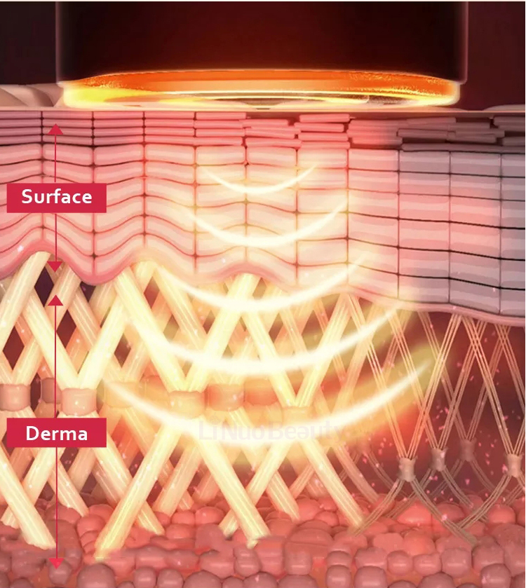 أحدث آلة RF Microneedling للعناية بالوجه وتجديد شباب البشرة سر RF 4 إبر علاج ندبات حب الشباب RF ميكرونيدل كسري