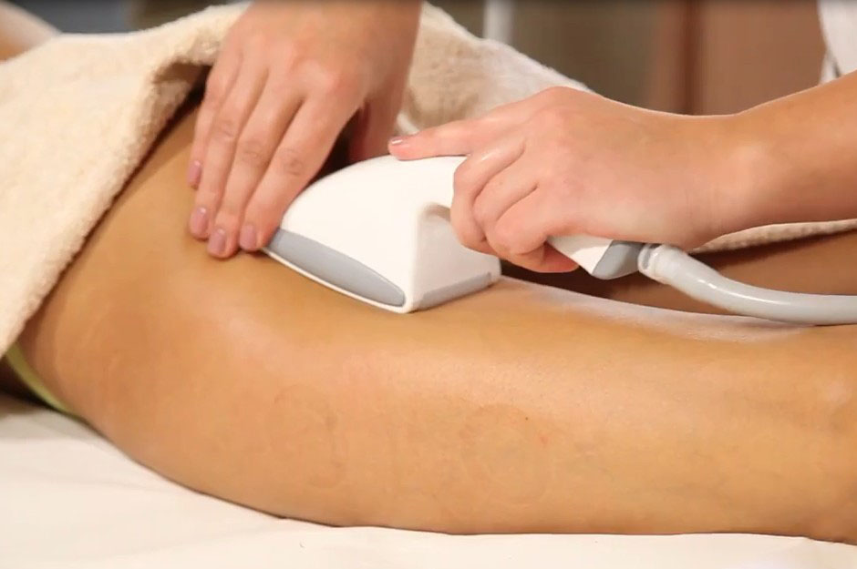 آلة العلاج بالفراغ ستارفاك سب2 ذات الشاشة التي تعمل باللمس لعلاج الكوب بالفراغ والتخسيس