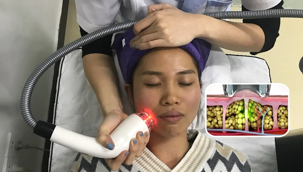 تشكيل الجسم بجهاز EMS 4 في 1 مع أسطوانة تفريغ و RF