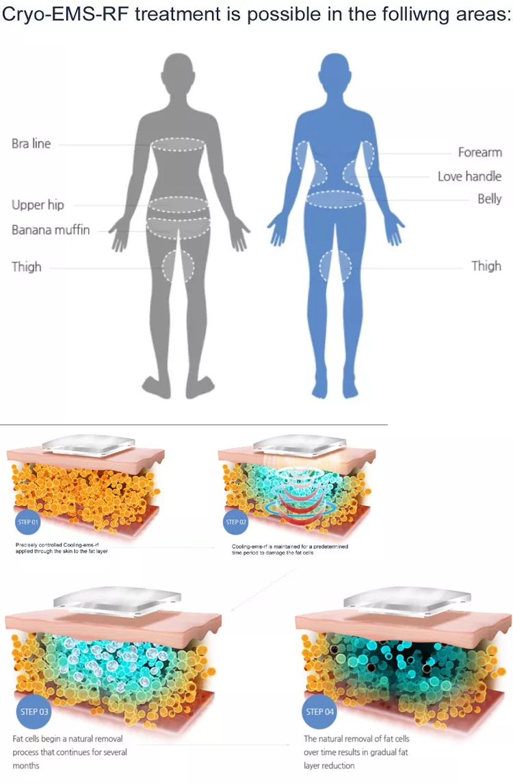 آلة تنحيف الدهون الجديدة 2023 ألواح البكاء آلة تسييل الدهون كولدتيك جهاز تجميد الدهون بالتبريد