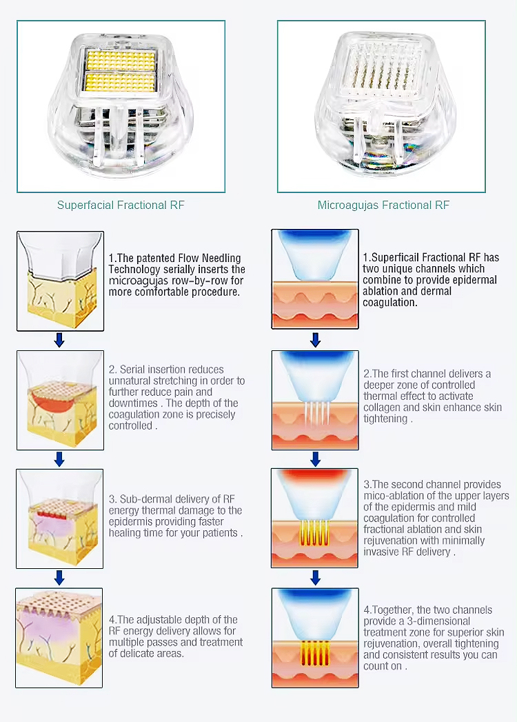صورة لجهاز ميكرونيدلينج
