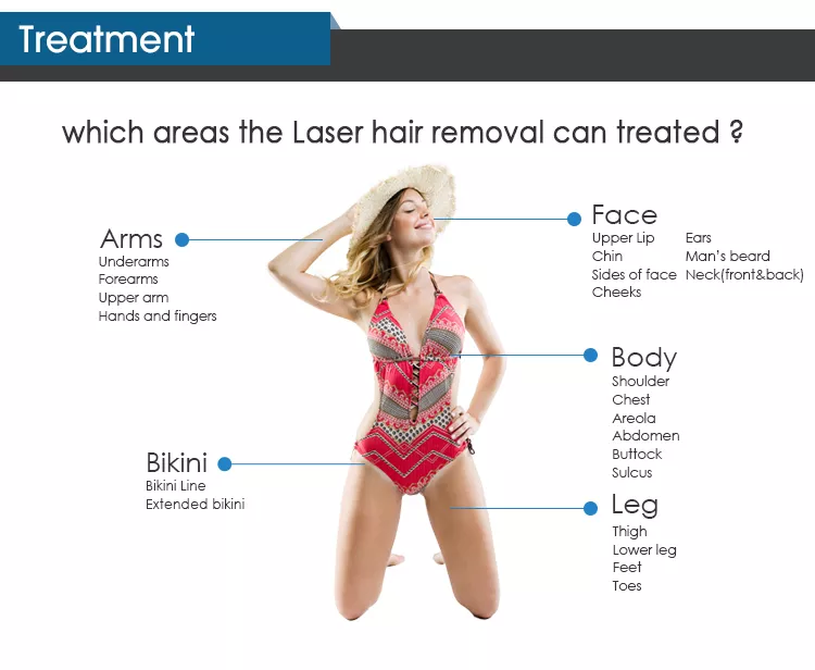 صورة لجهاز إزالة الشعر بالليزر أثناء العمل