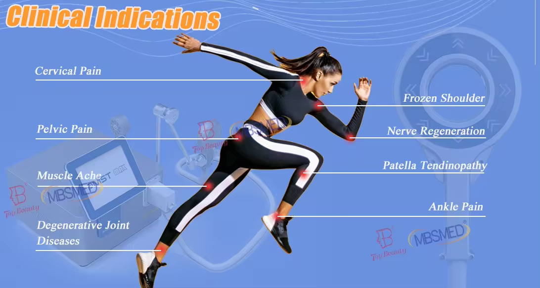 العلاج بالتحويل المغناطيسي خارج الجسم معتمد من CE لتطبيق العلاج على الجسم بالعلاج المغناطيسي الفيزيائي النبضي