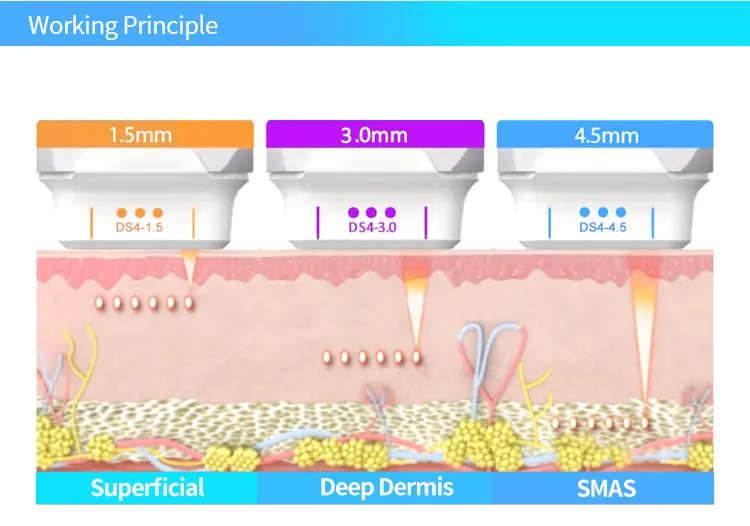 جهاز إعادة تأهيل الجلد بالموجات فوق الصوتية مع دوران 360 درجة لإزالة التجاعيد، جهاز MMFU الرأسي 4D