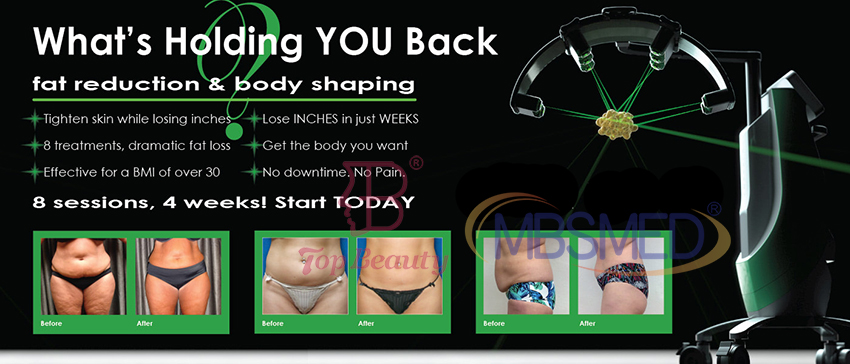 Lipo Laser Fat Removal Body Slimming Machine 6D 10D 1060Nm Diode Lipo Laser Green Light Slimming Machine