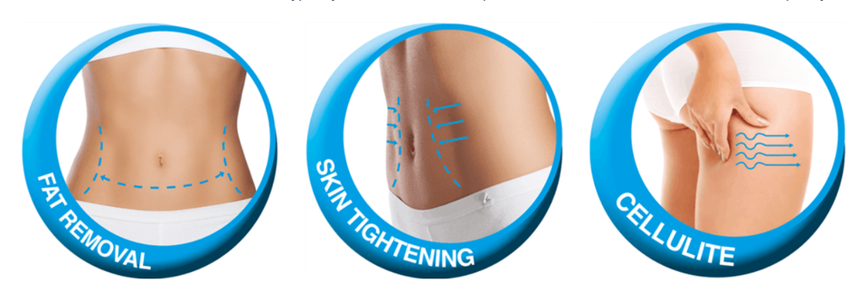 أفضل سعر لآلة نحت الجسم بالتبريد الدهون تجميد