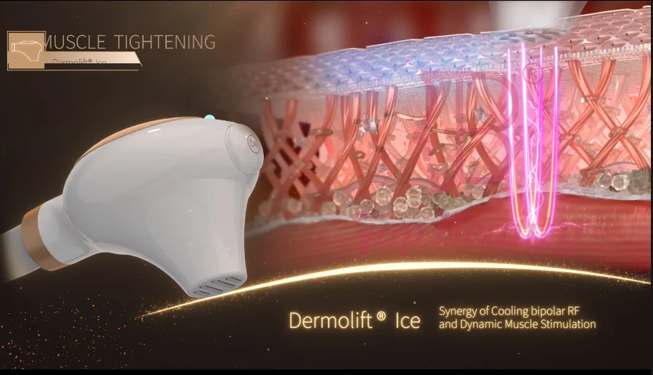 آلة شد الجلد عالية التردد لعام 2023 VDHF rf radio أفضل جهاز لإزالة التجاعيد ومعدات العناية بالوجه رفع ملامح الوجه