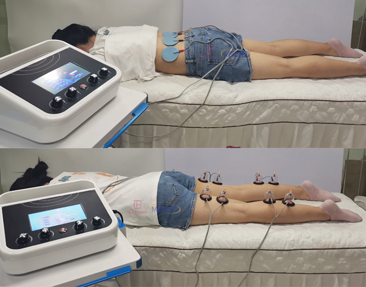 محفز عضلات EMS لتنحيف الجسم موجة روسية التحفيز الكهربائي كأس حجامة تجميل الثدي جهاز العلاج بالتفريغ
