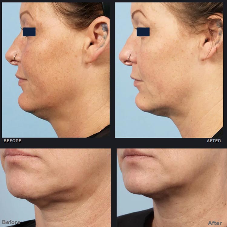 صورة للعلاج