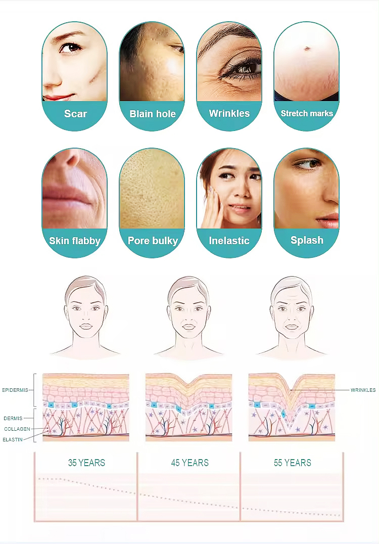 صورة لنتائج جهاز ميكرونيدلينج