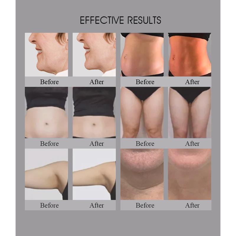 3 في 1 صالون استخدام Trusculpt Id Flex Rf نحت الجسم نحت الجسم 2 ميجاهرتز علاج السيلوليت تقليل الدهون آلة Trufat