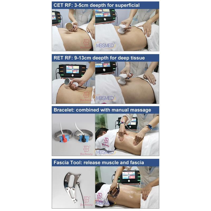 علاج بالراديو الترددات الراديوية إنديبا سيت ري تيكار إنديبا 448 كيلو هرتز آلة علاج تيكار