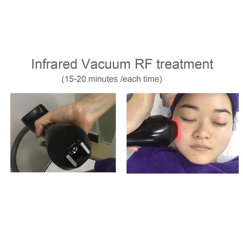 وصول جديد لعام 2023 جهاز تدليك باللفافة المفرغة لتشكيل الجسم وتقليل الدهون