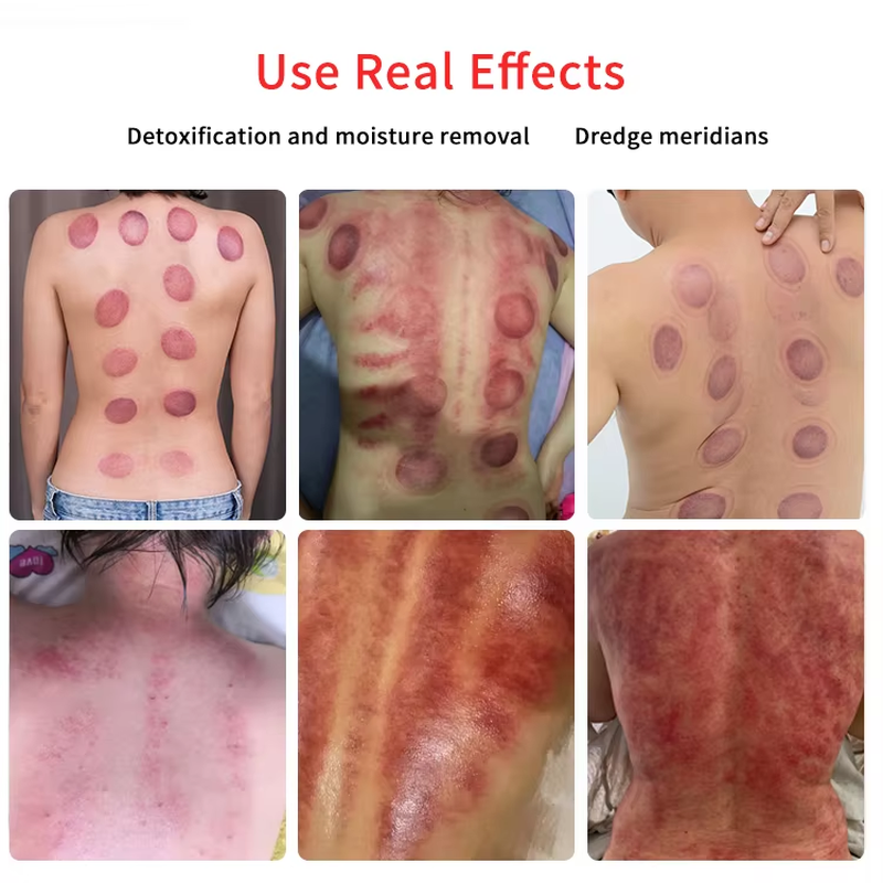 محفز عضلات EMS لتنحيف الجسم موجة روسية التحفيز الكهربائي كأس حجامة تجميل الثدي جهاز العلاج بالتفريغ