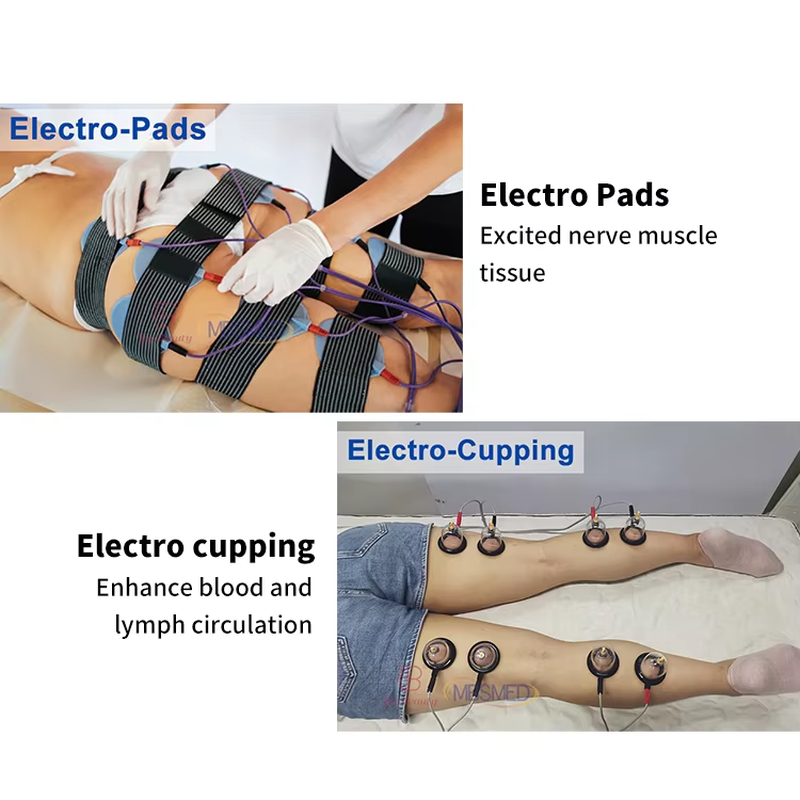 محفز عضلات EMS لتنحيف الجسم موجة روسية التحفيز الكهربائي كأس حجامة تجميل الثدي جهاز العلاج بالتفريغ