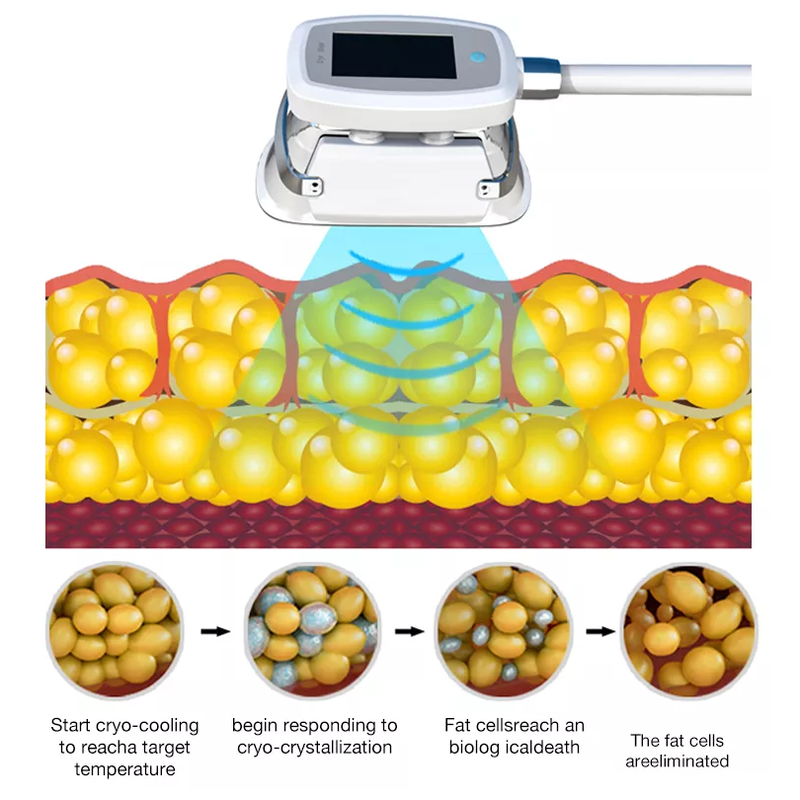 آلة كريو 360 لعام 2022، آلة تكسير الدهون بالتبريد بأسعار أفضل لإنقاص الوزن عن طريق تكسير الدهون بالتبريد