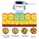 آلة كريو 360 لعام 2022، آلة تكسير الدهون بالتبريد بأسعار أفضل لإنقاص الوزن عن طريق تكسير الدهون بالتبريد